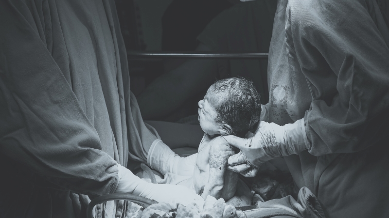 Cesarean Childbirth | Beyond Fertility